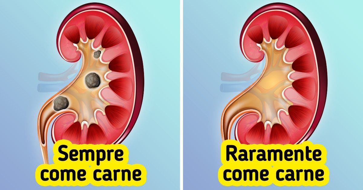 O que pode acontecer com seu corpo quando você come muita carne O que pode acontecer com seu corpo quando você come muita carne