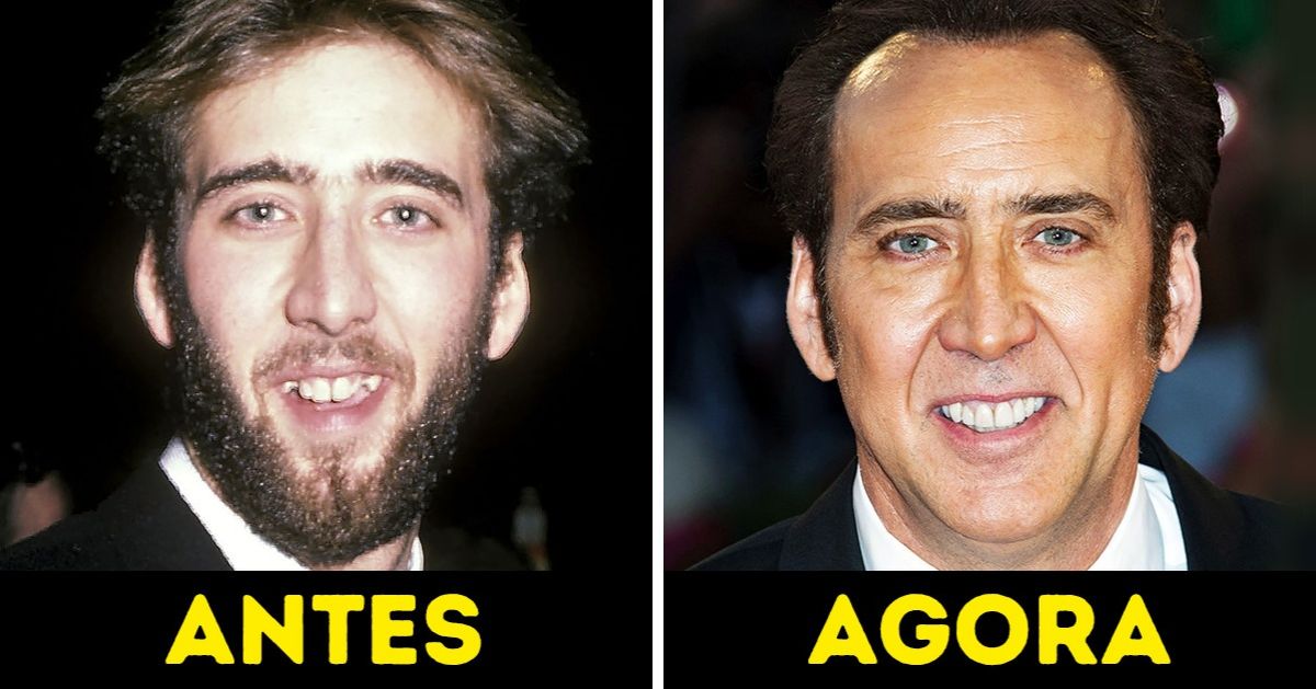 20 Celebridades que mudaram muito ao longo das últimas décadas