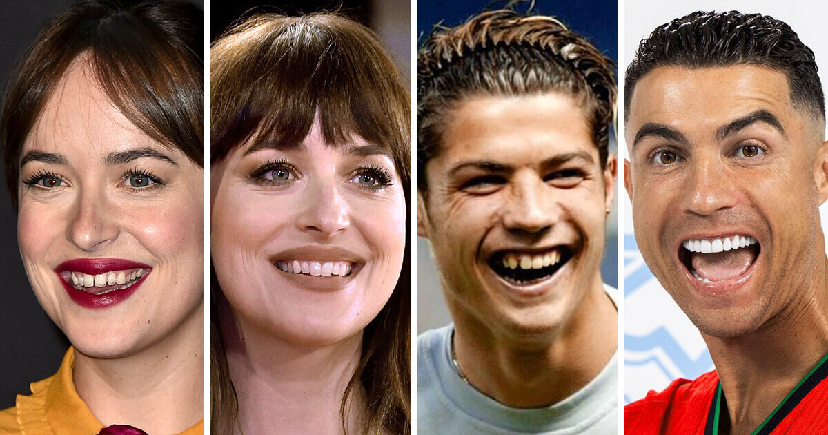 20+ Sorrisos de celebridades capazes de iluminar qualquer ambiente 20+ Sorrisos de celebridades capazes de iluminar qualquer ambiente