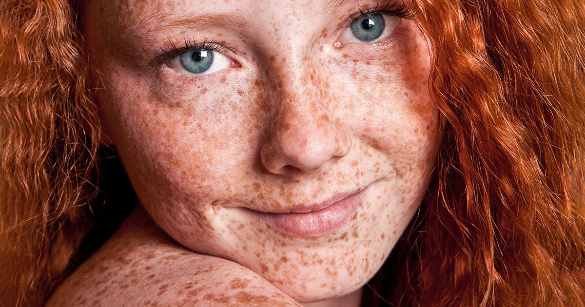 10+ Traços únicos que fazem dos ruivos tão especiais