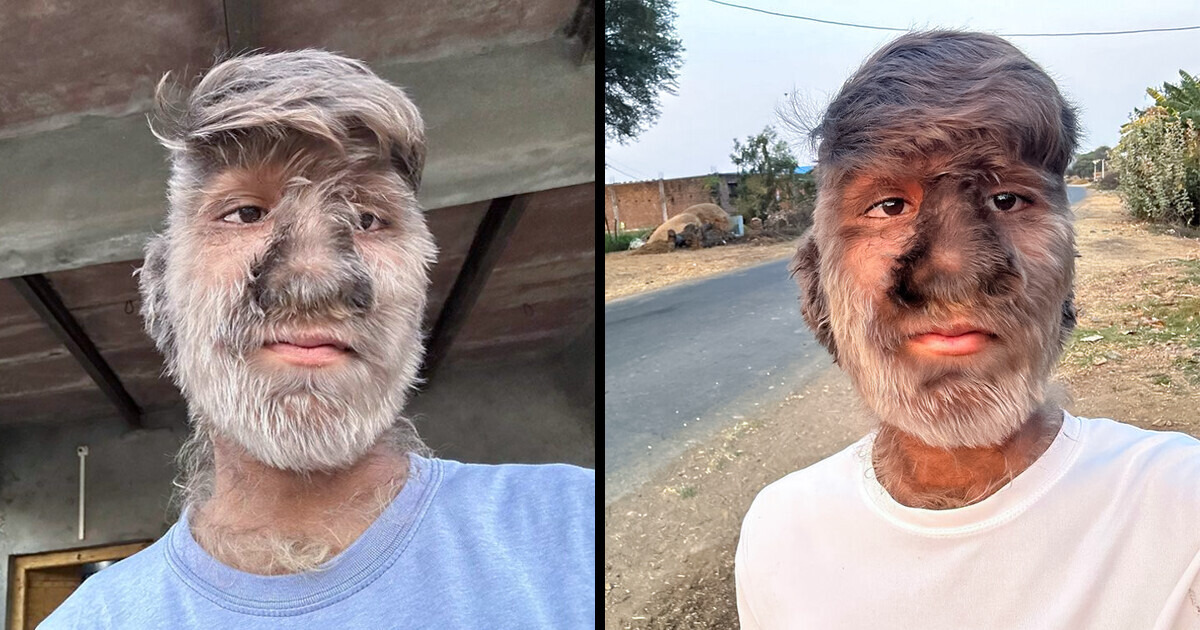 Apesar das adversidades, o rapaz rotulado como “Macaco” inicia seu vlog para inspirar e superar estereótipos Apesar das adversidades, o rapaz rotulado como “Macaco” inicia seu vlog para inspirar e superar estereótipos