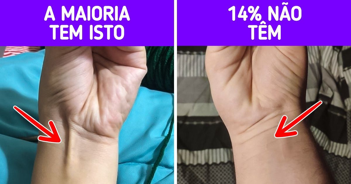 10 Traços físicos que tornam as pessoas que os possuem exceção à regra 10 Traços físicos que tornam as pessoas que os possuem exceção à regra