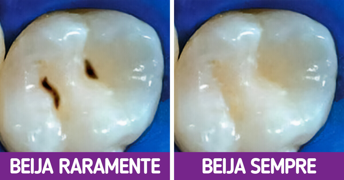 O que acontece com seu corpo quando você beija muito O que acontece com seu corpo quando você beija muito