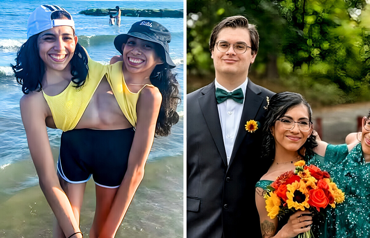 Uma das gêmeas siamesas se casa, e todos querem saber a mesma coisa Uma das gêmeas siamesas se casa, e todos querem saber a mesma coisa