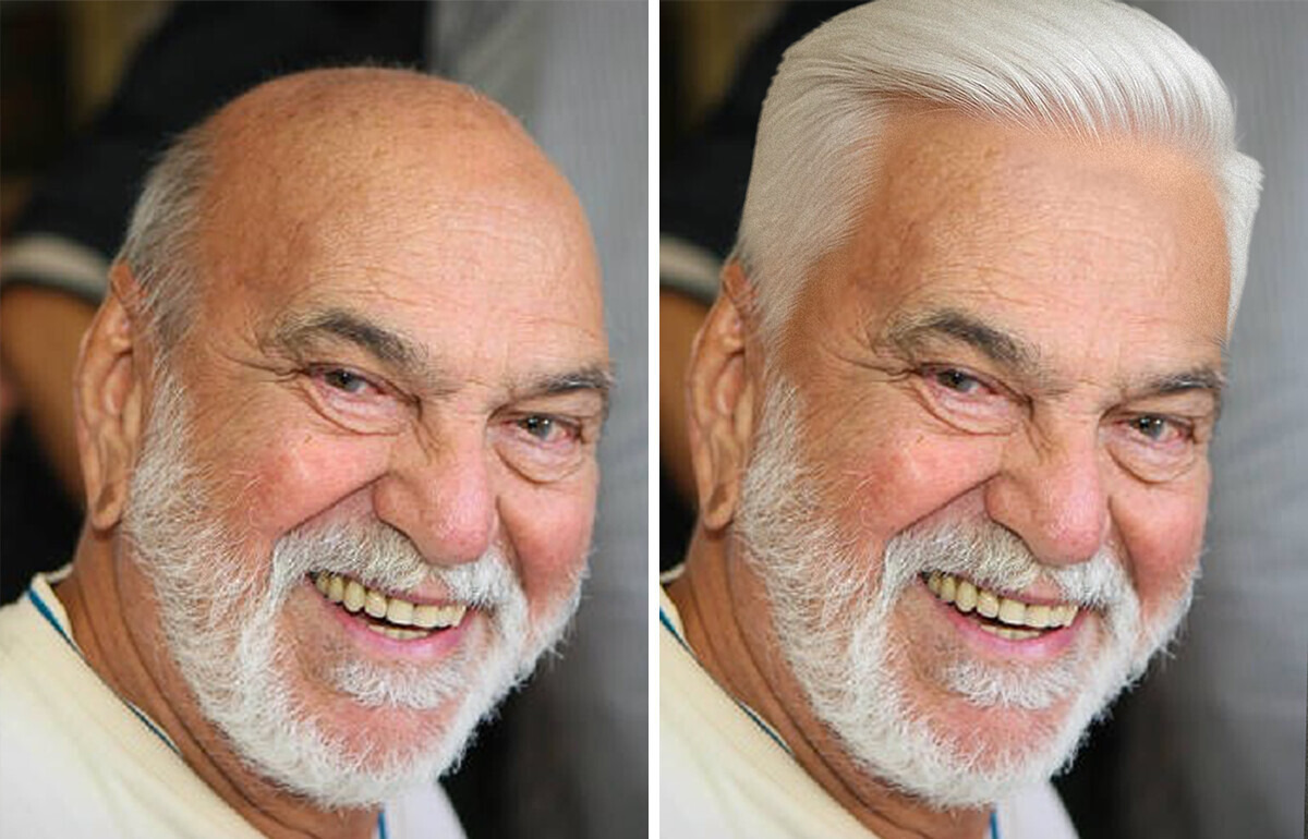 Como seriam 18 famosos se a calvície nunca tivesse chegado