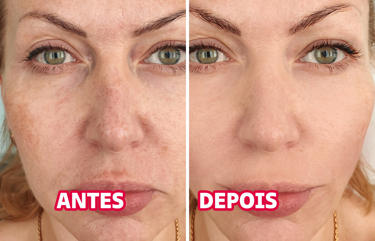 12 Maneiras de eliminar o inchaço matinal e acabar com a “cara de sono”