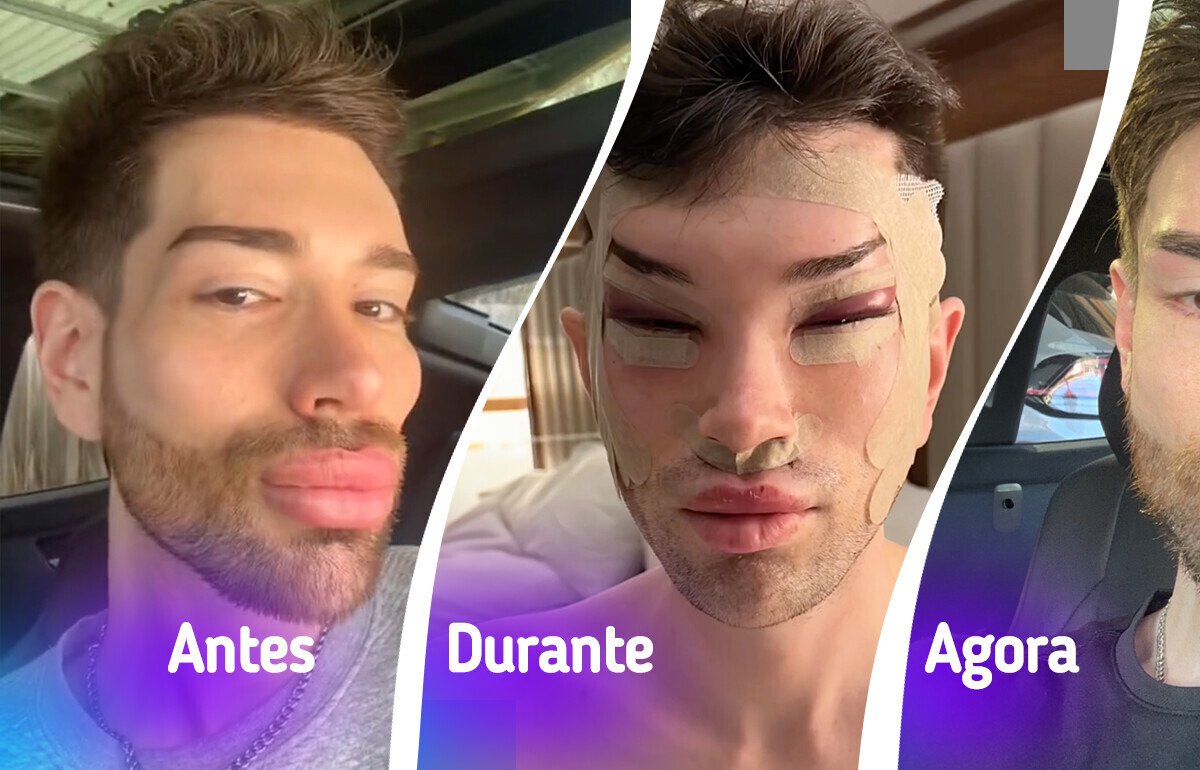 Ex-Ken Humano surpreende ao abandonar aparência plástica e adotar novo visual