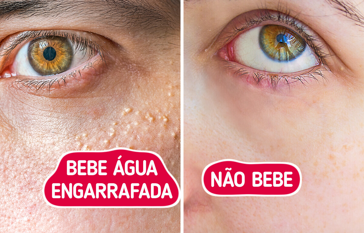 Como os tipos de água afetam nossa saúde, das baratas às mais caras Como os tipos de água afetam nossa saúde, das baratas às mais caras