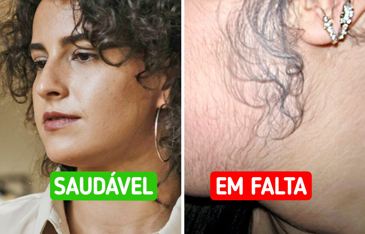 5 Alarmes que o corpo dispara quando a vitamina D está em falta