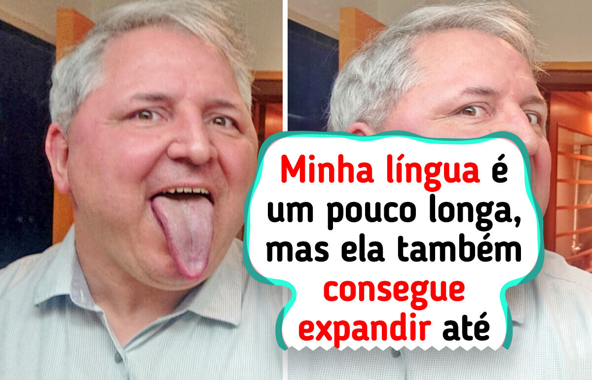 15 Traços corporais raros que mostram como a natureza adora surpreender