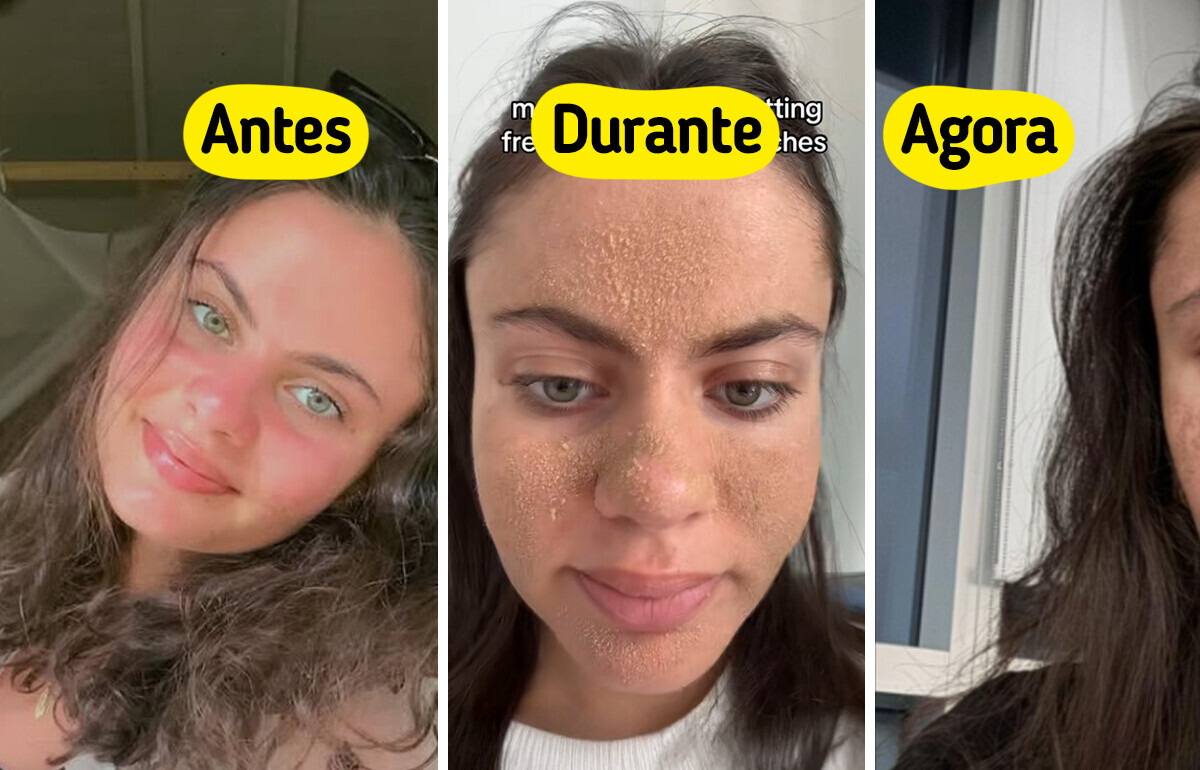 Mulher para de lavar o rosto, abandona skincare e surpreende com a transformação