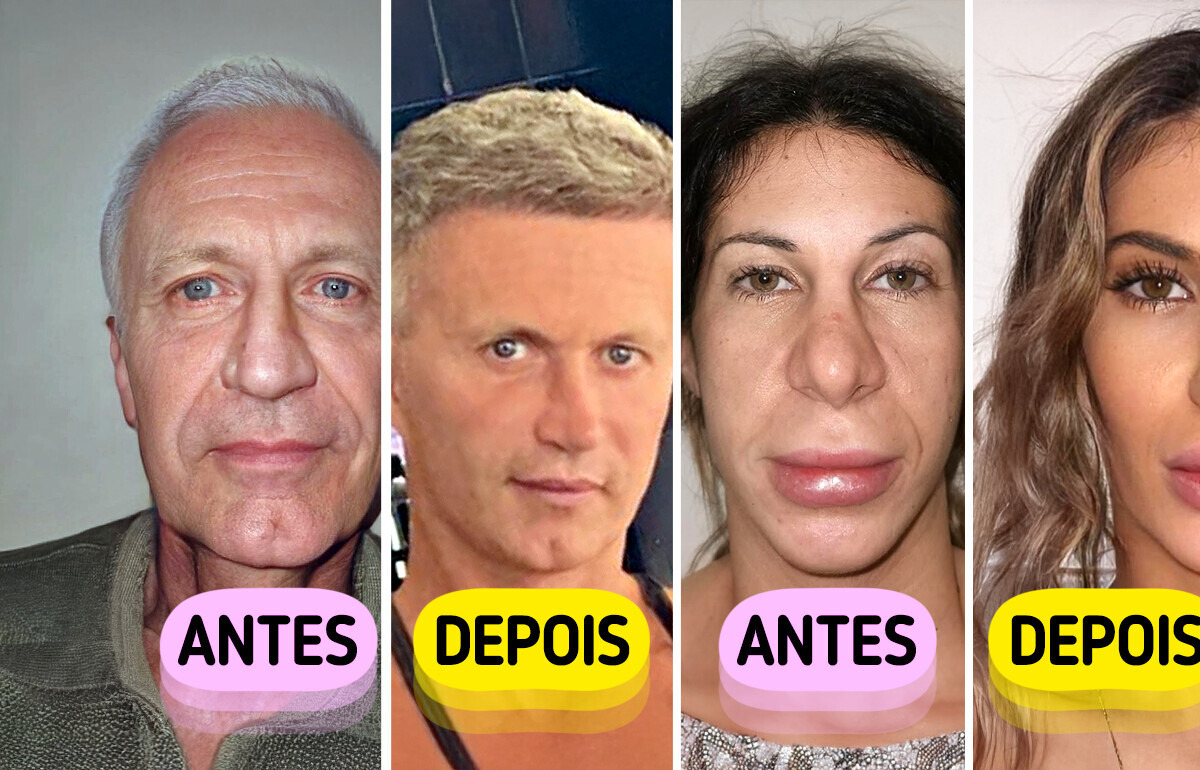 Clínica usa proporção áurea em cirurgias plásticas para fazer transformações impressionantes