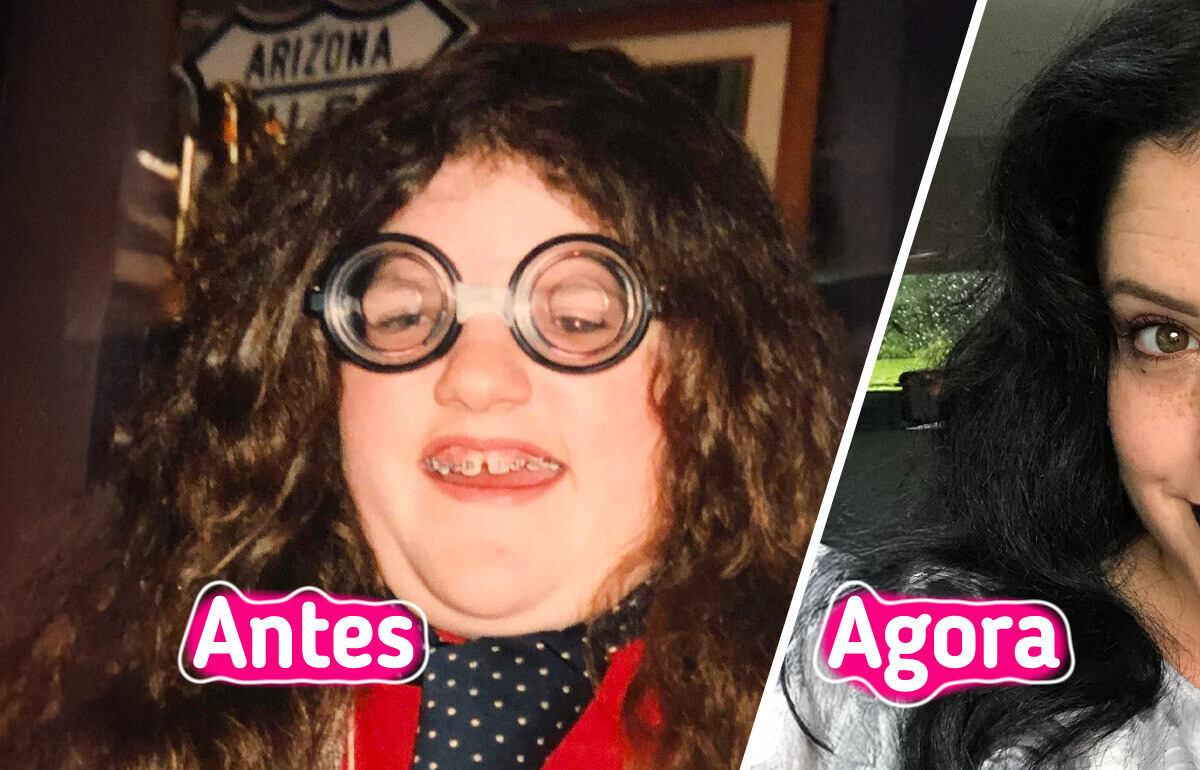 16 Pessoas compartilham fotos marcantes que mostram de verdade o que é uma transformação