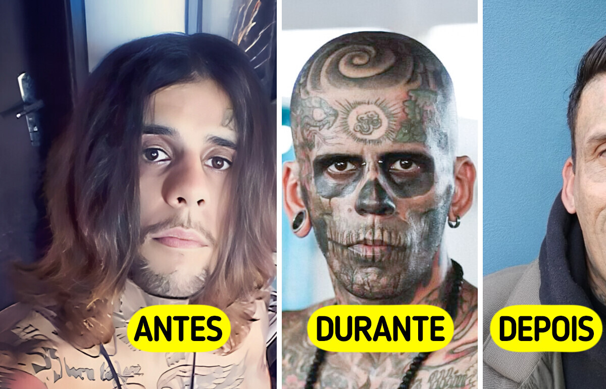 Brasileiro com 95% do corpo tatuado mostra transformação impressionante após remoção a laser