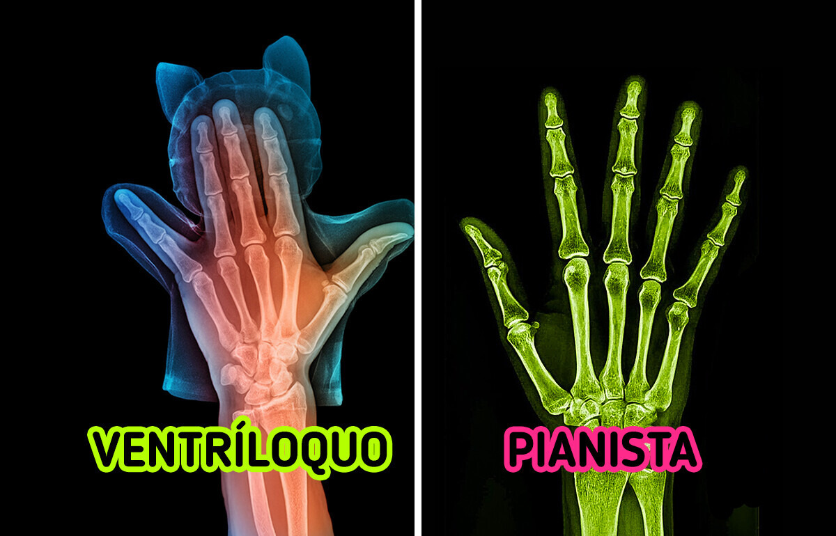 15 Radiografias que revelam o que está oculto bem na nossa frente