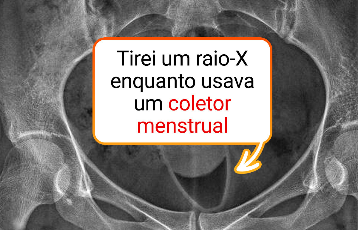 15 Imagens reais que bagunçaram a cabeça de quem viu