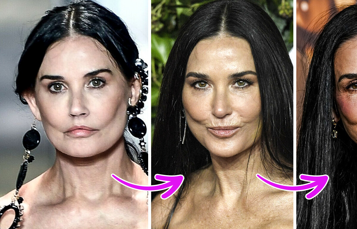 Especialistas explicam o mistério do que pode ter acontecido com o rosto de Demi Moore