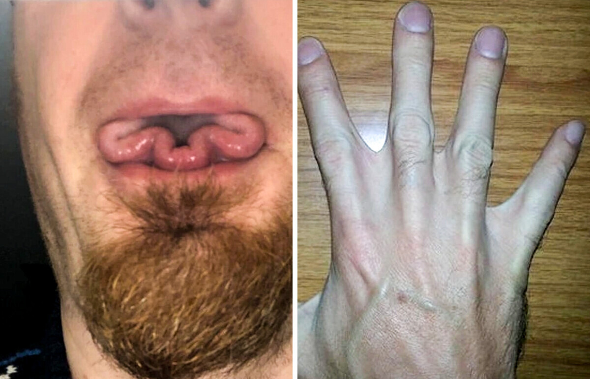 14 Traços raros do corpo humano que certamente fazem seus donos se destacarem