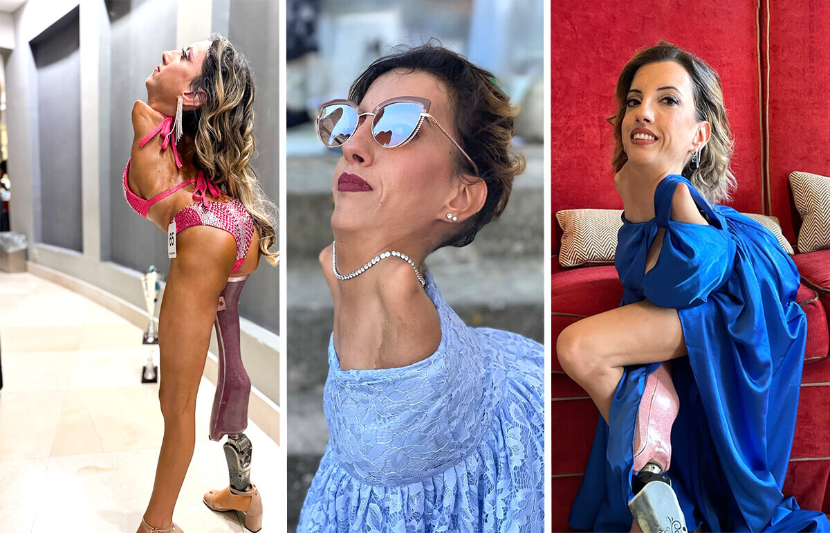 Mesmo com uma condição rara, ela desafiou rótulos e virou inspiração para muita gente Mesmo com uma condição rara, ela desafiou rótulos e virou inspiração para muita gente