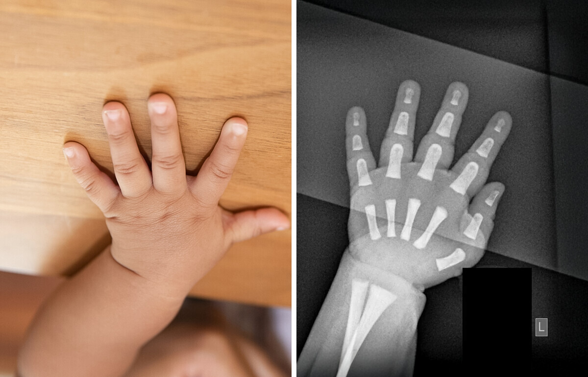 20 Raios X e ressonâncias tão inusitadas que nem os mais céticos vão ficar indiferentes