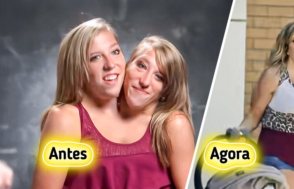 Abby e Brittany, professoras siamesas que fizeram da vida uma mensagem de amor