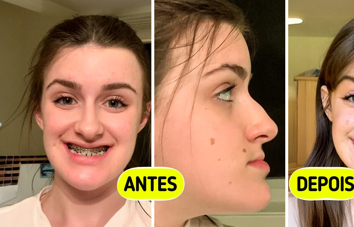 20 Pessoas que viveram uma metamorfose no visual e hoje exibem sua melhor versão