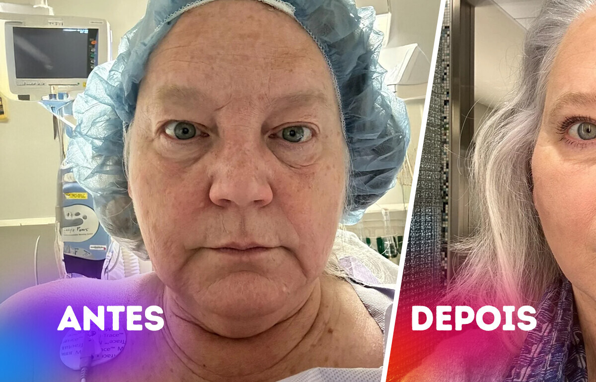 16 Plásticas que mostraram como o bisturi pode criar uma obra de arte