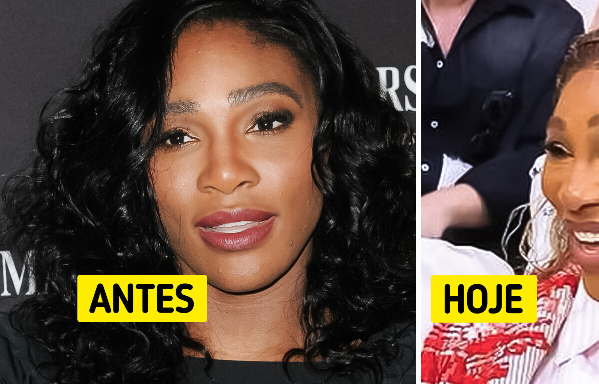 Serena Williams aparece com novo visual e reacende debate sobre exagero no uso de botox