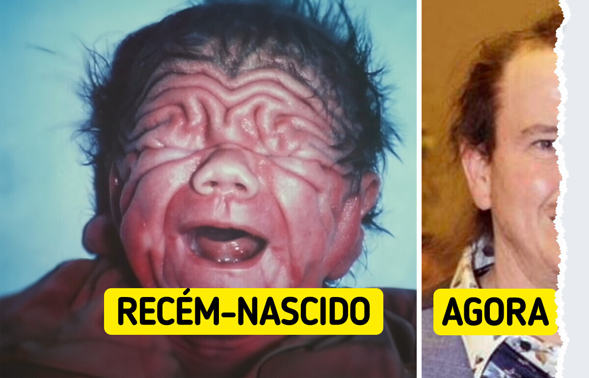 A história do bebê que desafiou todas as probabilidades