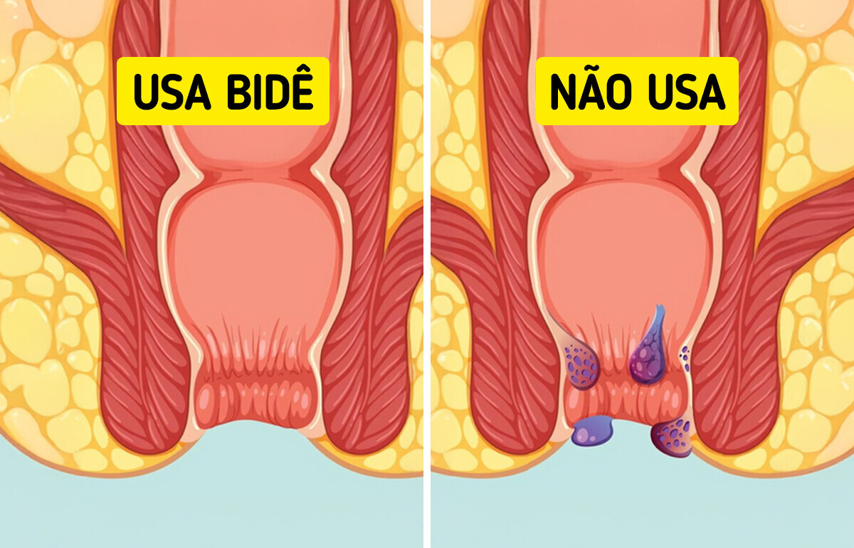 Trocar o papel higiênico por um bidê pode melhorar sua saúde íntima
