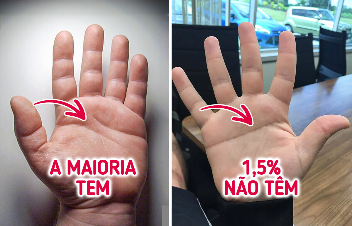 12 Características físicas tão raras que parecem superpoderes