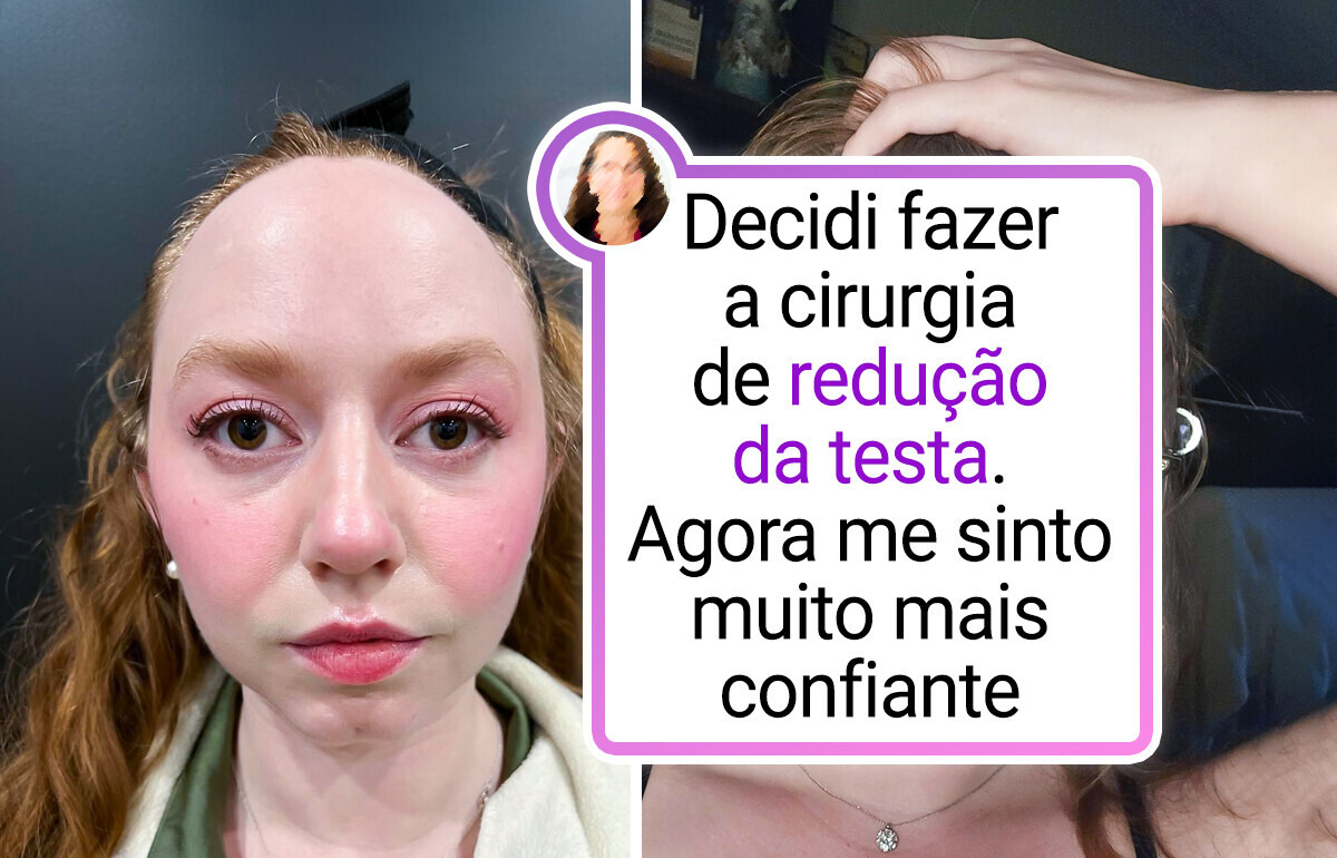 20+ Fotos que mostram claramente o que é uma “grande diferença”