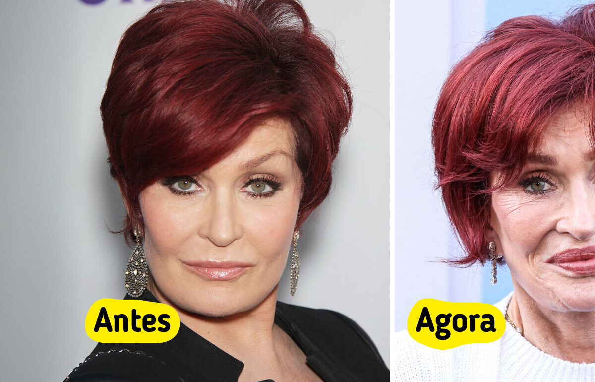 “Fui longe demais”, Sharon Osbourne finalmente revela a verdade sobre sua transformação estética