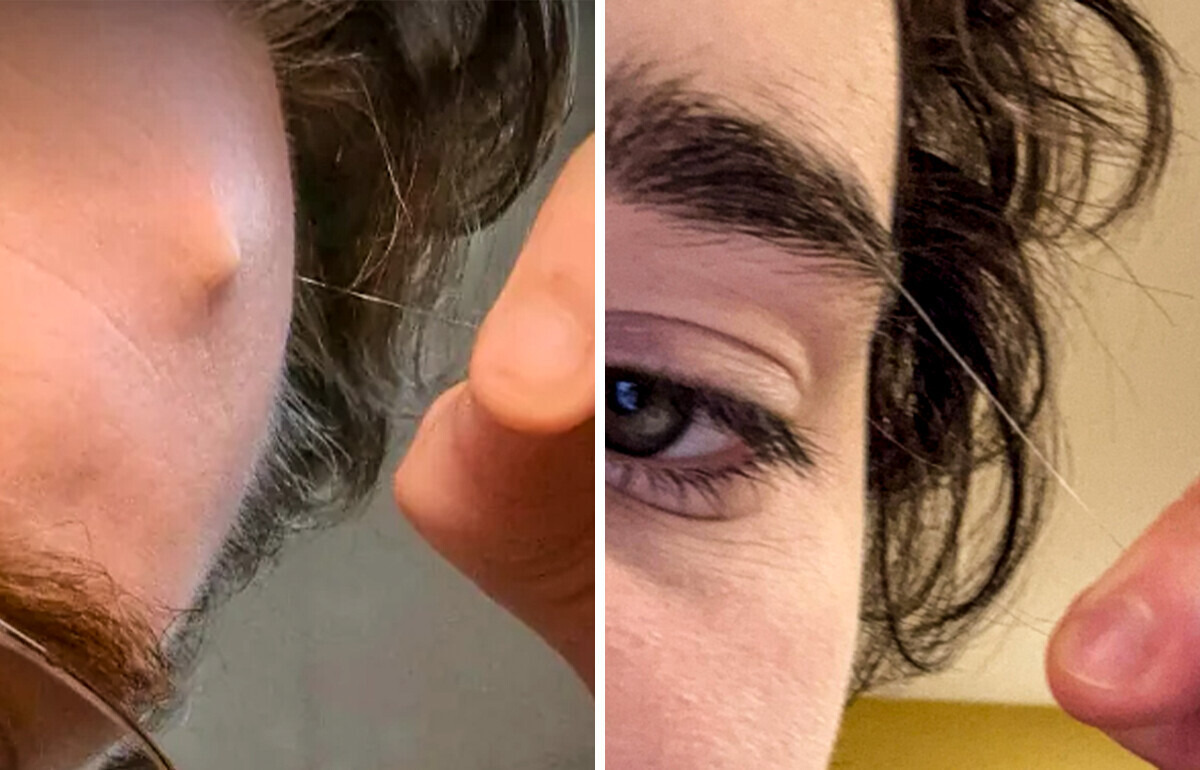 Por que alguns fios de cabelo decidem quebrar as regras do crescimento