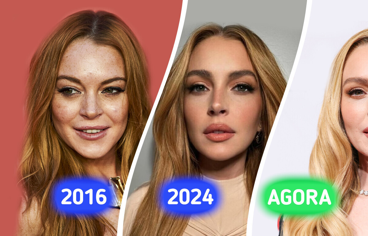 Novo visual de Lindsay Lohan choca a internet e cirurgião aponta o que mudou