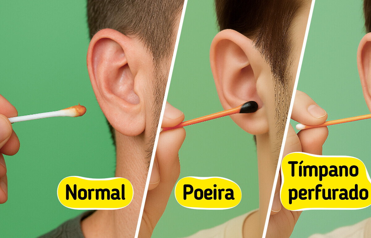 5 Cores de cera de ouvido que podem indicar um problema de saúde oculto 5 Cores de cera de ouvido que podem indicar um problema de saúde oculto