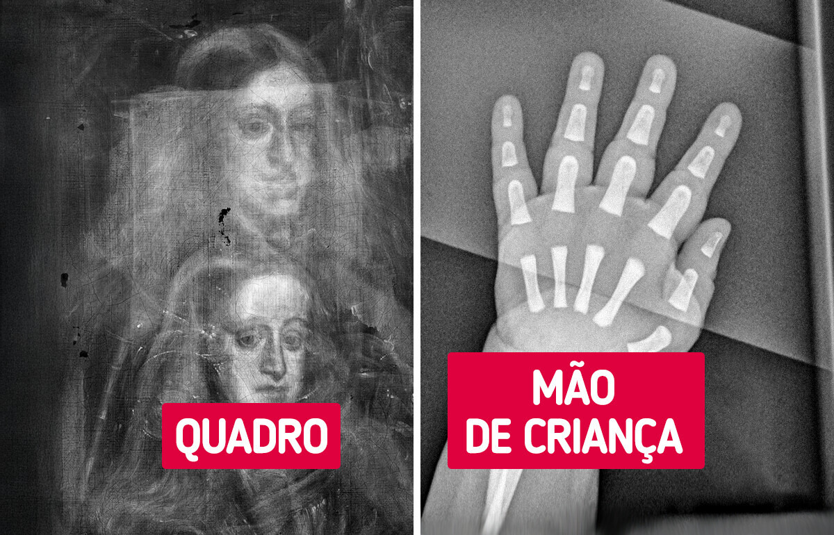 20+ Radiografias que revelam detalhes do mundo invisíveis a olho nu