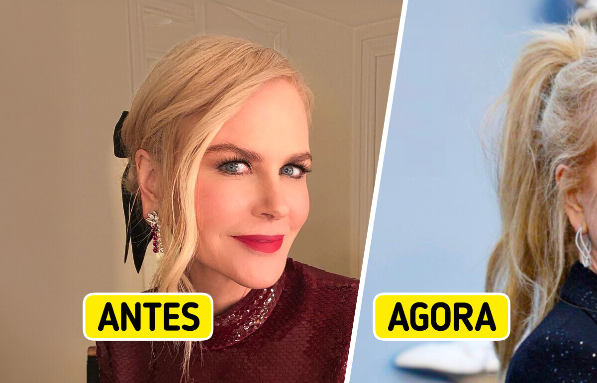 Nicole Kidman surge com detalhe no rosto que intrigou fãs