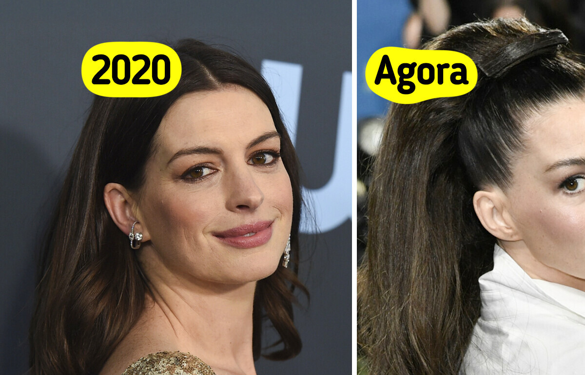Anne Hathaway surge irreconhecível em novas fotos e divide opiniões