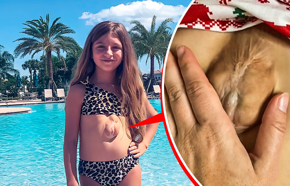 Menina nasce com coração fora do peito, desafiando médicos que duvidaram de sua vida Menina nasce com coração fora do peito, desafiando médicos que duvidaram de sua vida