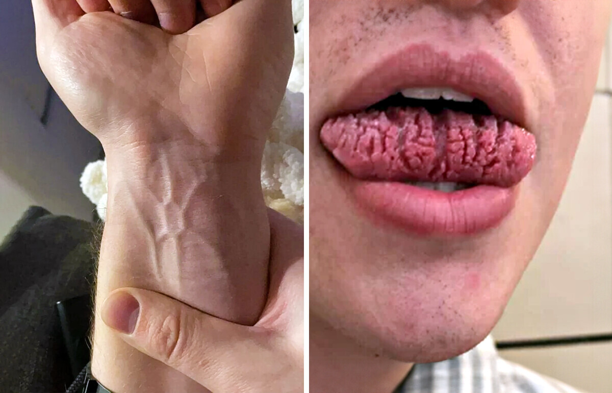 18 Mutações genéticas tão únicas que viralizaram com milhares de curtidas