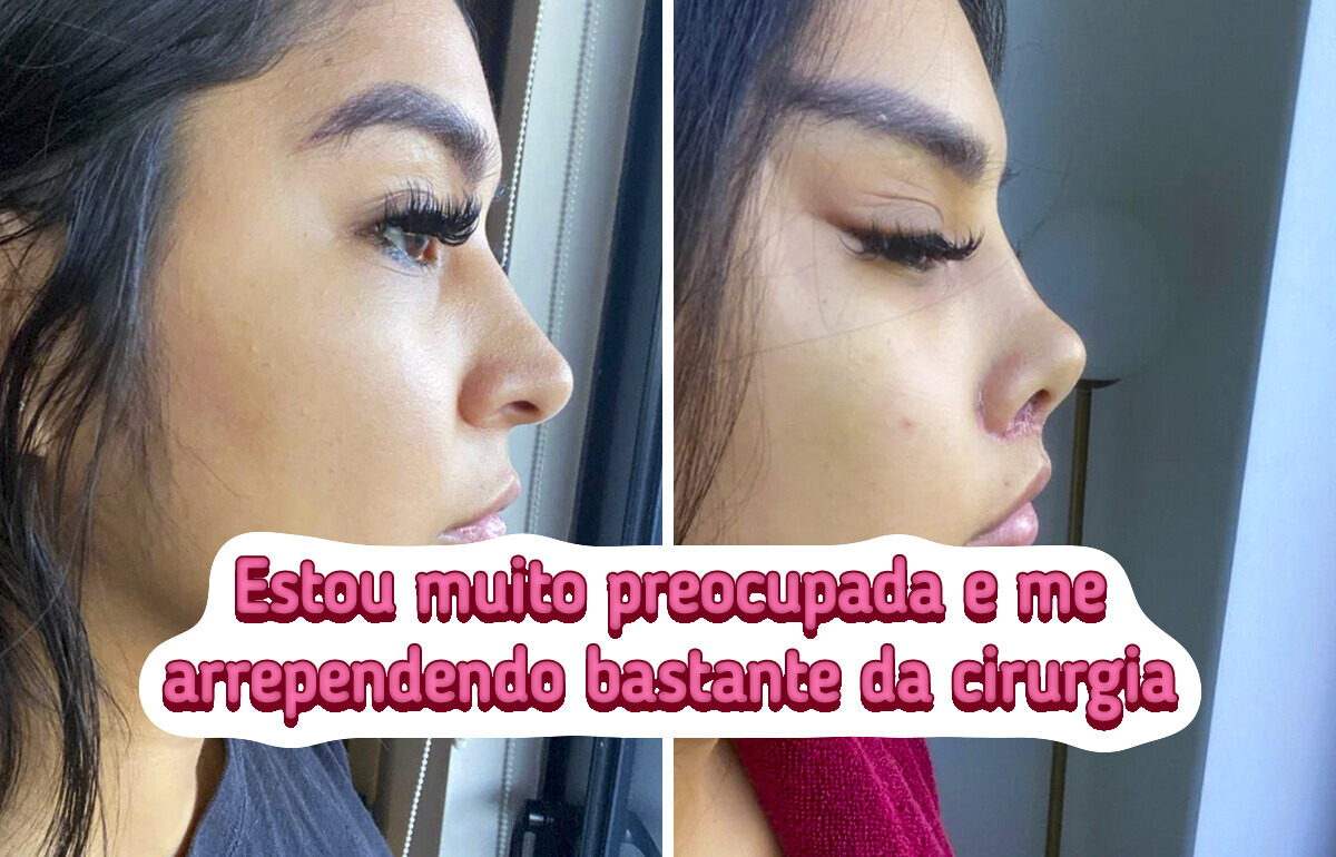 16 Pessoas que apostaram em procedimentos estéticos e se decepcionaram com o resultado 16 Pessoas que apostaram em procedimentos estéticos e se decepcionaram com o resultado
