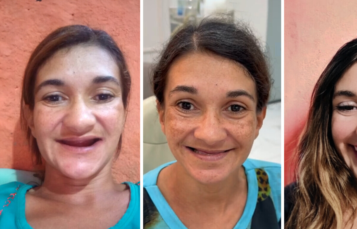 Mãe atípica de 5 filhos rejuvenesce 20 anos após transformação visual