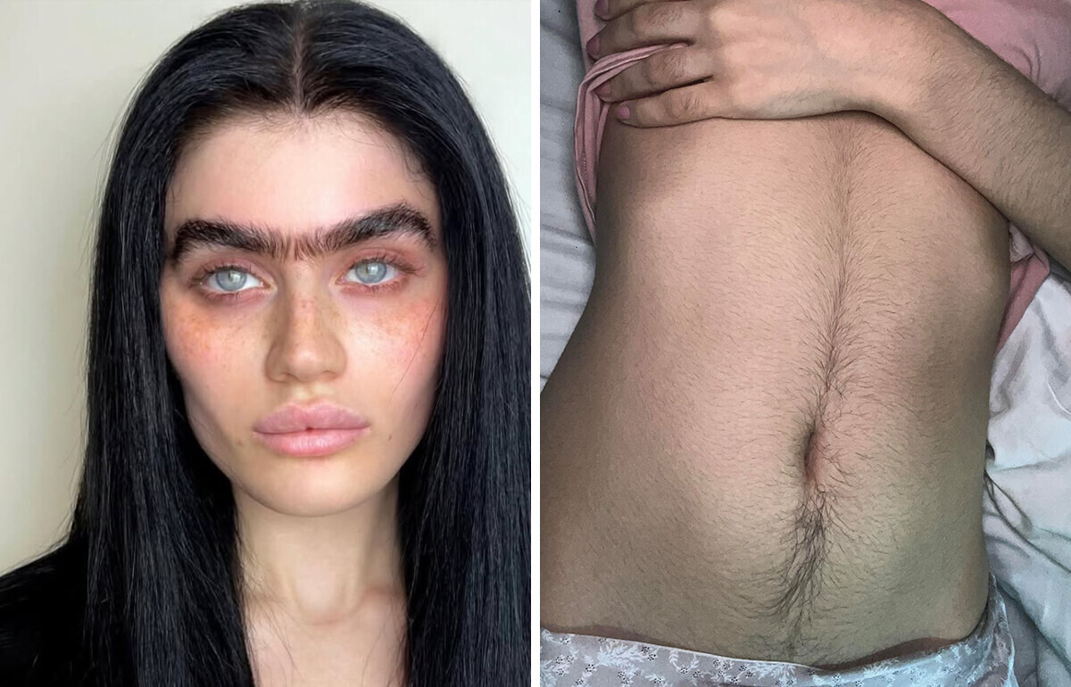 Estas 15 mulheres provam que pelos no corpo não são motivo para vergonha