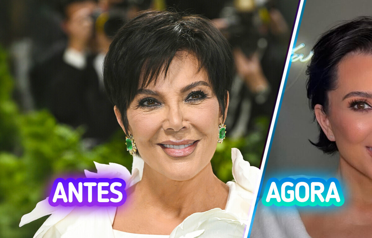 “Melhor lifting de todos”: após cirurgia, Kris Jenner aparece com metade da idade