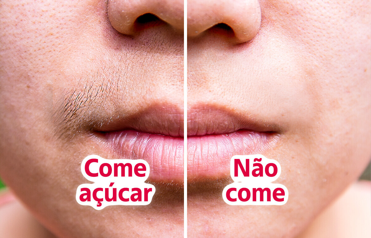 6 Alternativas naturais para prevenir o aparecimento de pelos faciais