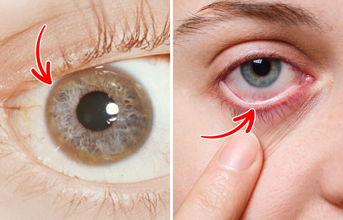 12 Sinais nos olhos que podem ser o primeiro alerta de que algo não vai bem