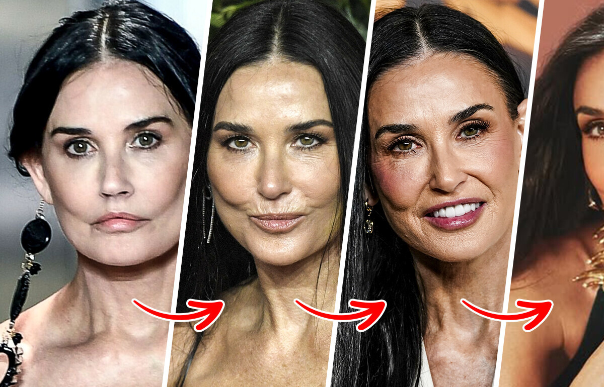 Cirurgião comenta aparência de Demi Moore: “Ela claramente tirou algumas coisas”