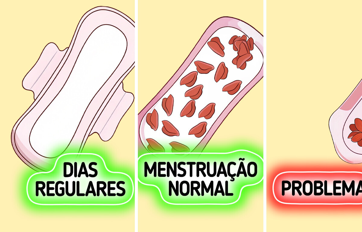 10 Sintomas alarmantes que podem indicar endometriose, fique de olho 10 Sintomas alarmantes que podem indicar endometriose, fique de olho