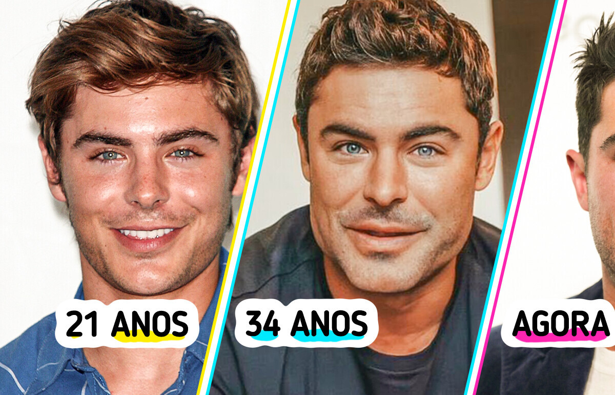 Zac Efron dá detalhes de como um acidente causou mudança no rosto